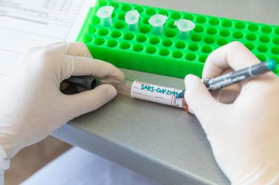 V laboratoři Nemocnice AGEL Prostějov vyšetřili v říjnu na koronavirus 12 tisíc vzorků. Podíl pozitivních přesáhl 40%
